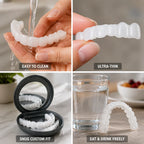 Cosmetic Veneers Open Palate Upper & Lower Set
