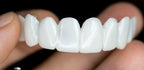 Removable Dental Veneers Natural-Looking Reusable Resin