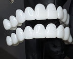 Removable Dental Veneers Natural-Looking Reusable Resin
