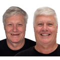 Removable Denture Set Upper & Lower Arches Flexible Cushion Grip