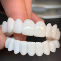 Dental Veneers Adjustable Reusable Lightweight