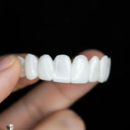 Dental Veneers Adjustable Reusable Lightweight