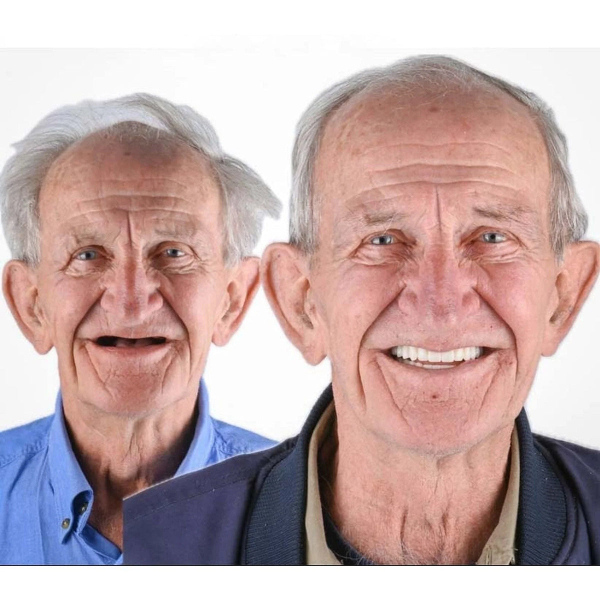 Denture Set Full-Arch Flexible Cushion Grip