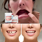 Denture Set Moldable Resin Upper & Lower