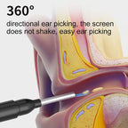 Ear Cleaning Camera 1080P HD Six LED Lights
