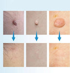 Skin Care Device Precision Tip Compact & Lightweight