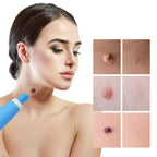 Skin Care Device Precision Tip Compact & Lightweight