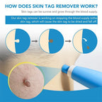 Skin Care Device Precision Tip Compact & Lightweight