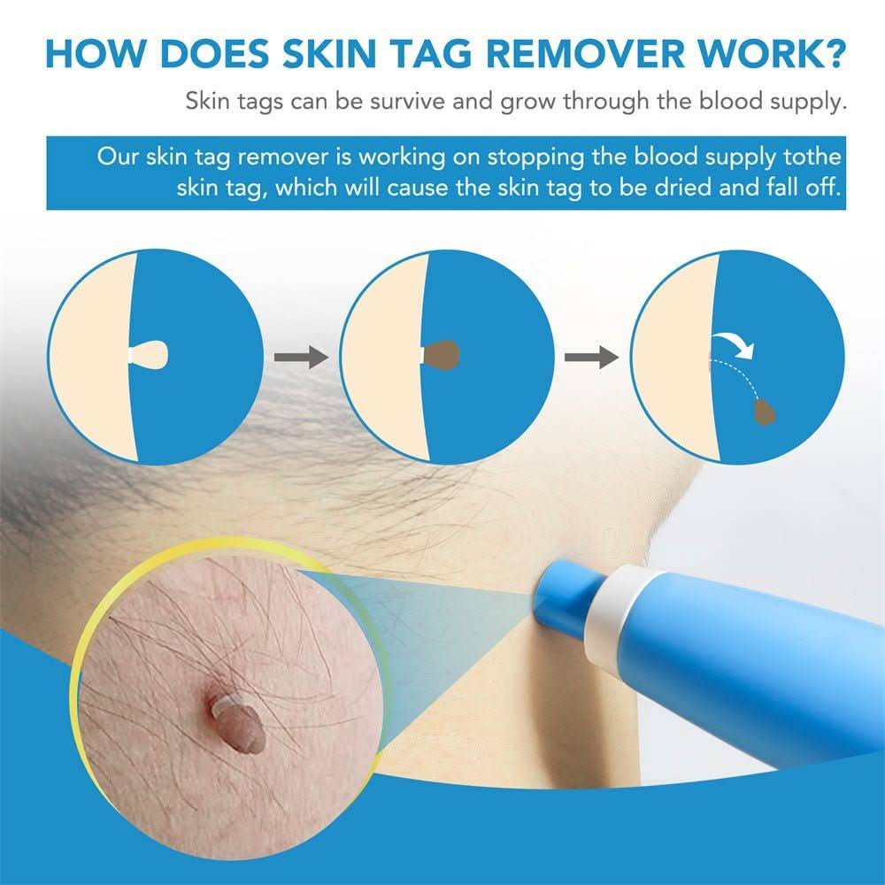 Skin Care Device Precision Tip Compact & Lightweight