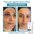 Skin Laser Pen Micro-Focused CO2 Compact Handheld