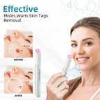 Skin Laser Pen Micro-Focused CO2 Compact Handheld