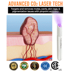 Skin Laser Pen Micro-Focused CO2 Compact Handheld