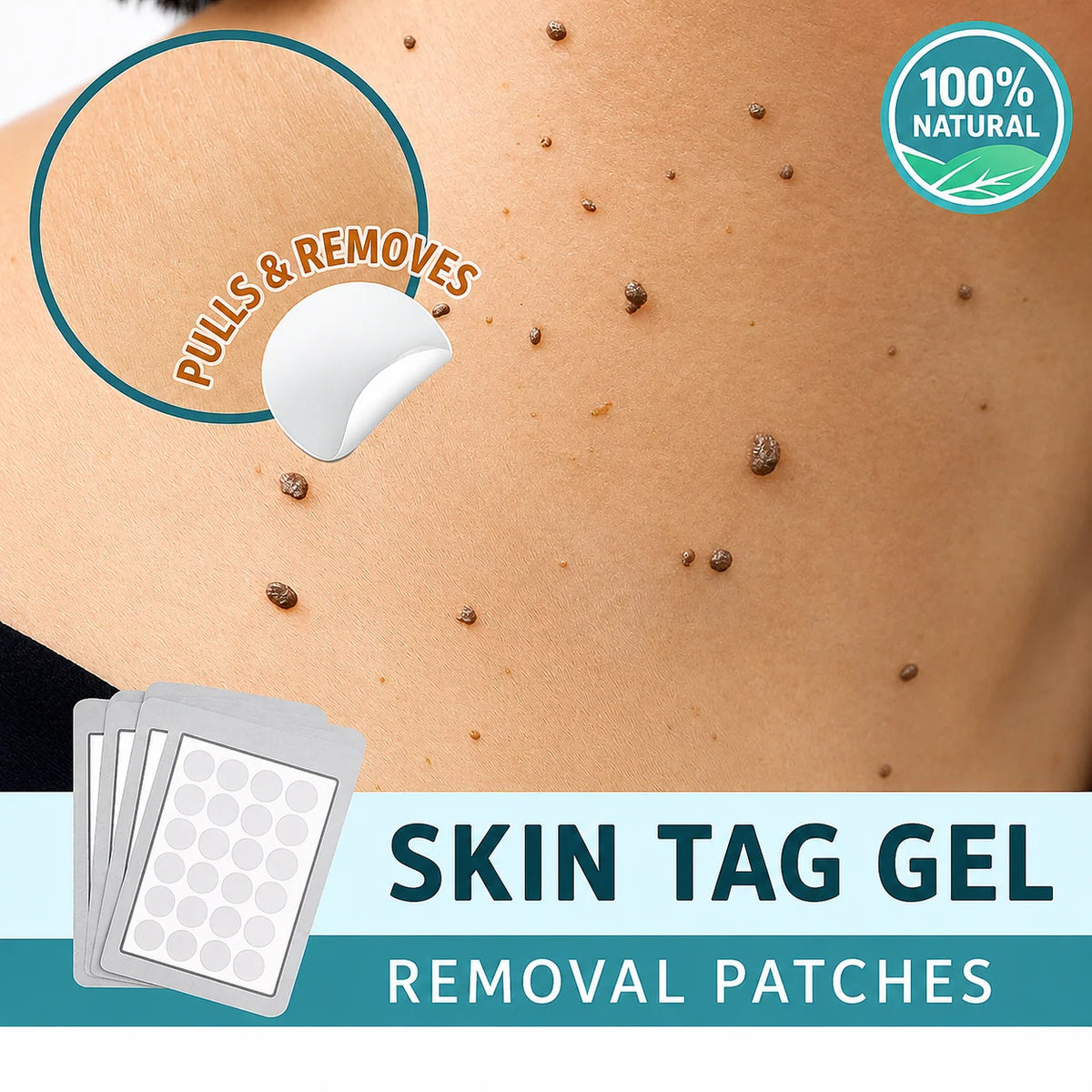 Skin Tag Patches Gentle & Discreet Wear