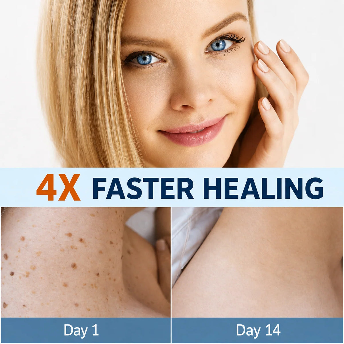 Skin Tag Patches Gentle & Discreet Wear