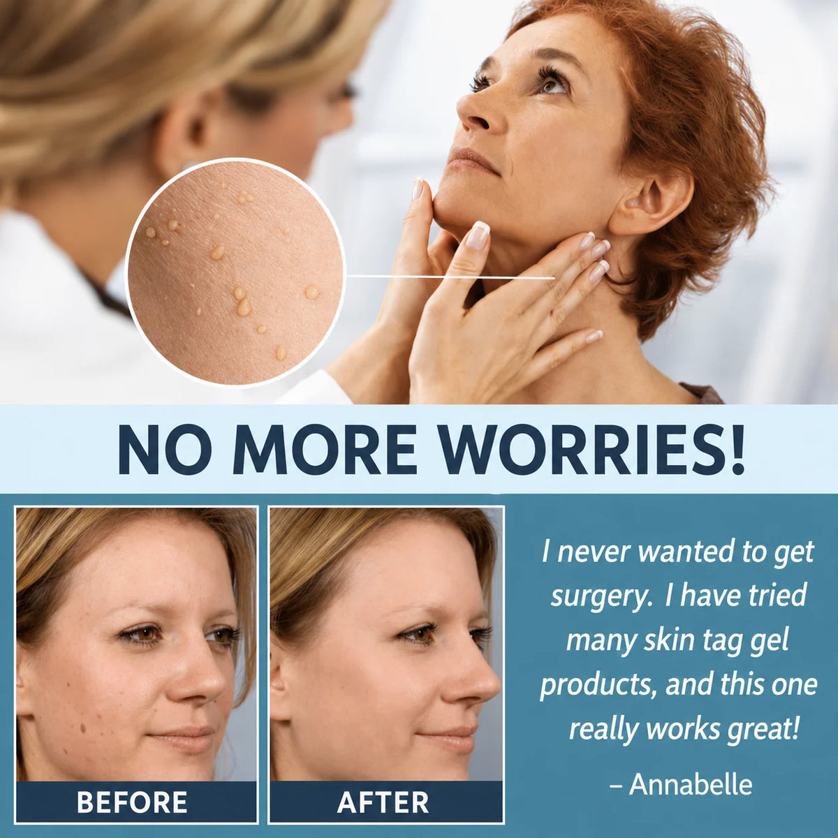 Skin Tag Patches Gentle & Discreet Wear