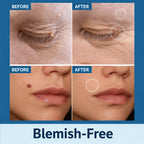Skin Tag Patches Gentle & Discreet Wear