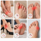 Toe Correction Bandage Rechargeable EMS Aluminum Splint & Adjustable Straps