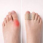 Toe Separator Gel Bunion Relief Low-Profile Pair