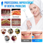 Ultrasonic Tooth Cleaner 5 Settings 3 Interchangeable Heads