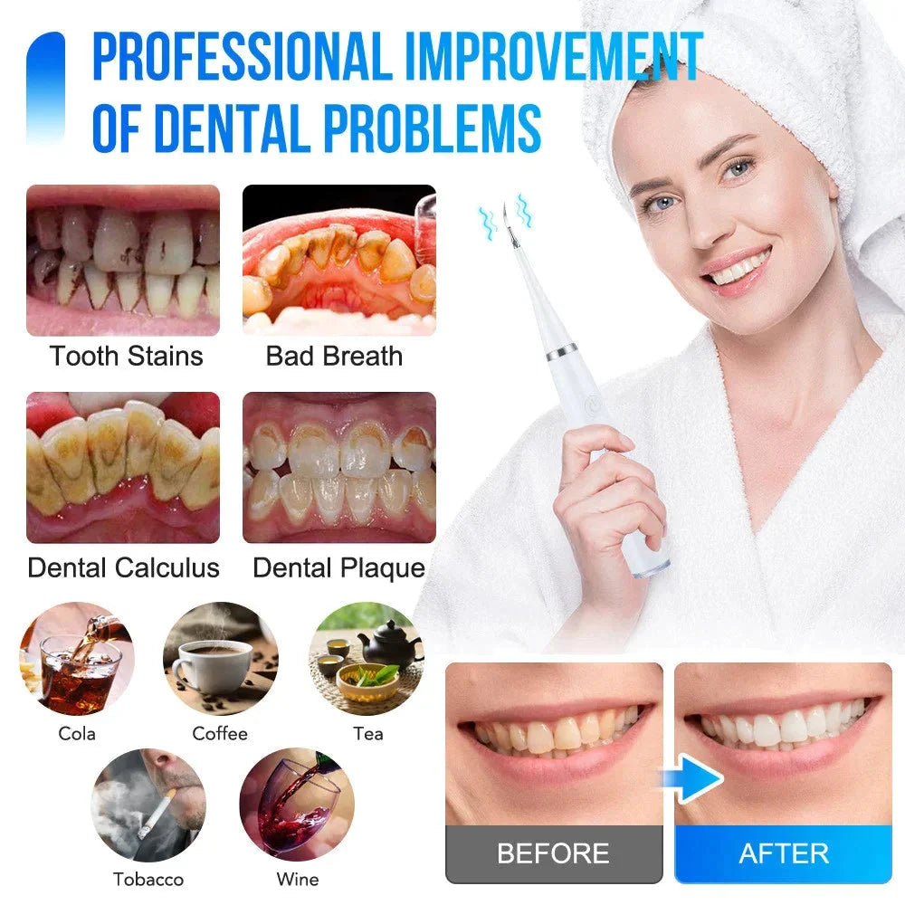 Ultrasonic Tooth Cleaner 5 Settings 3 Interchangeable Heads