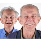 Removable Denture Set Upper & Lower Arches Flexible Cushion Grip